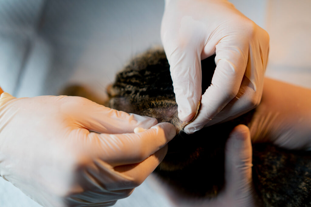 Hair Transplant