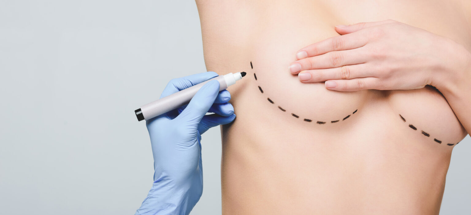 Breast Augmentation Surgery